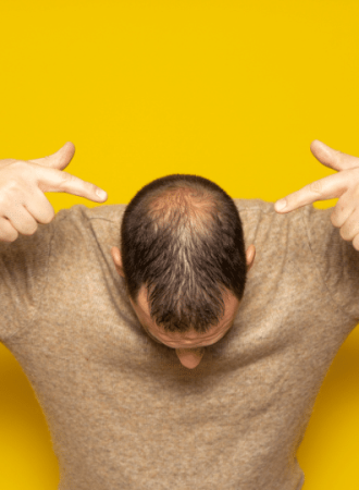 Cápsula para Alopecia Androgenética