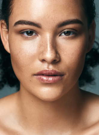 Sérum Melasma no More