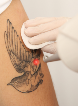 Pomada Pós Tatuagem