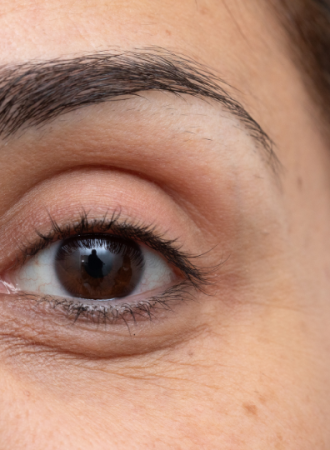 Creme para Olheiras Escuras Creme para Olheiras Escuras