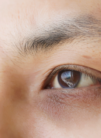 Creme para Olheiras Roxas Creme para Olheiras Roxas