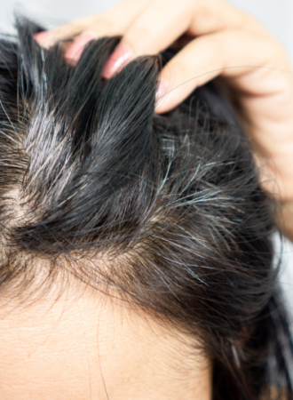 Cápsulas para Prevenção e Redução de Fios Brancos Cápsulas para Prevenção e Redução de Fios Brancos